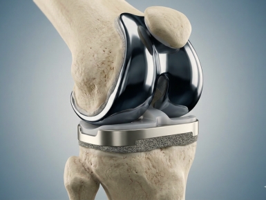 Joint Replacement